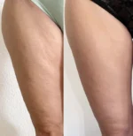 Body Sculpting Cream - Afbeelding 2